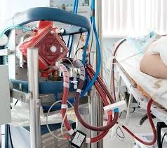 Extracorporeal Membrane Oxygenation (ECMO) Machine