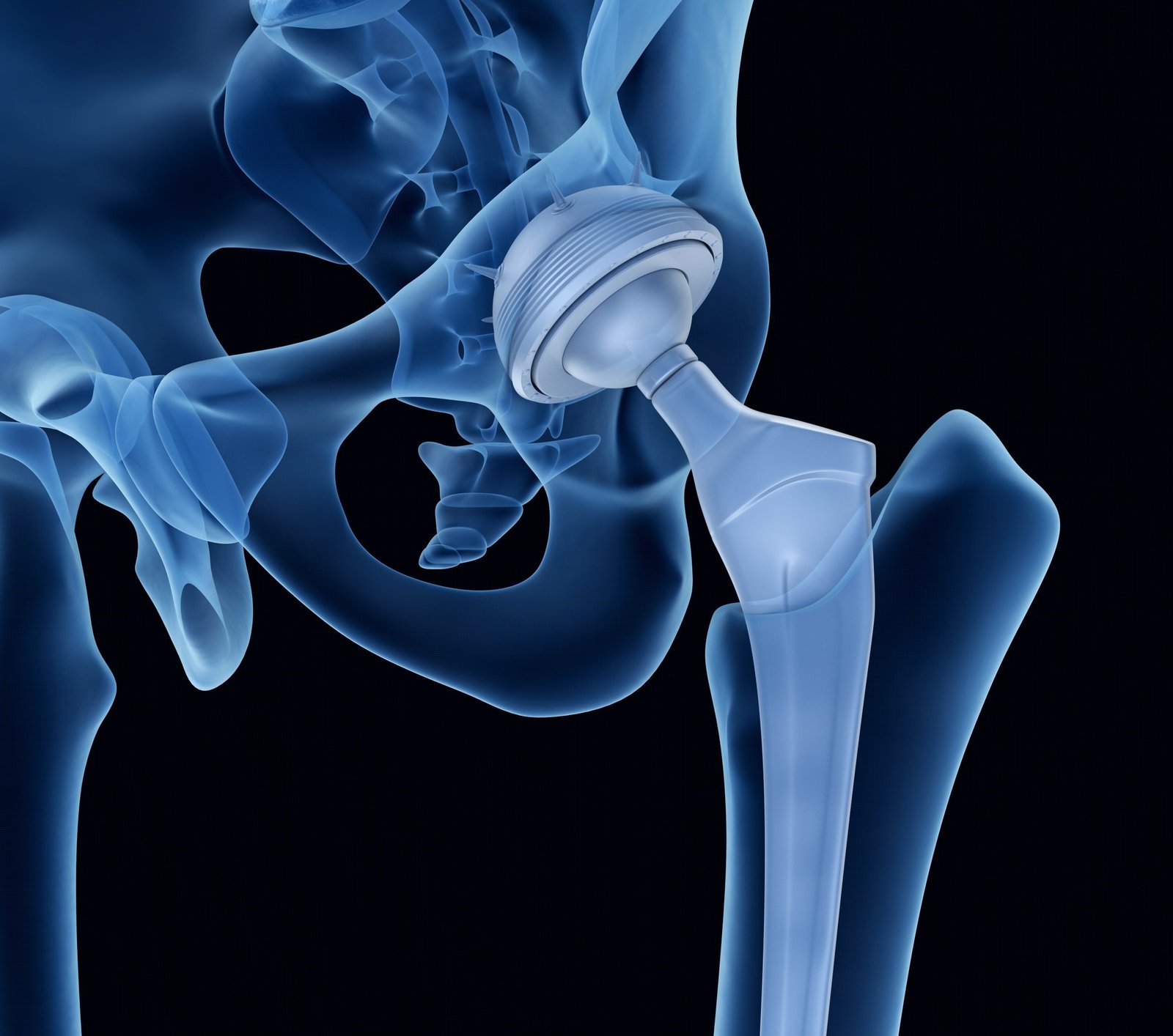 Hips Section